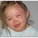 My daughter’s stroke & diagnosis of Moyamoya